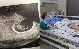 Vụ người vợ 28 tuổi hút mỡ bụng xong mới biết có thai: Bác sĩ thực hiện phẫu thuật sử dụng chứng chỉ giả