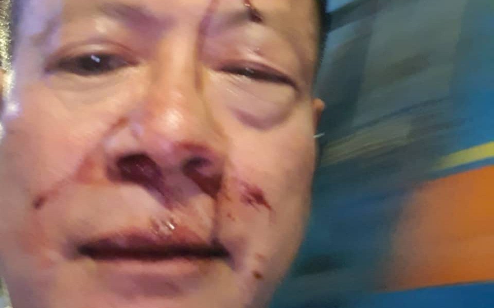 Nhóm thanh niên đánh Việt Kiều Đức trọng thương trong quán karaoke ở Sài Gòn