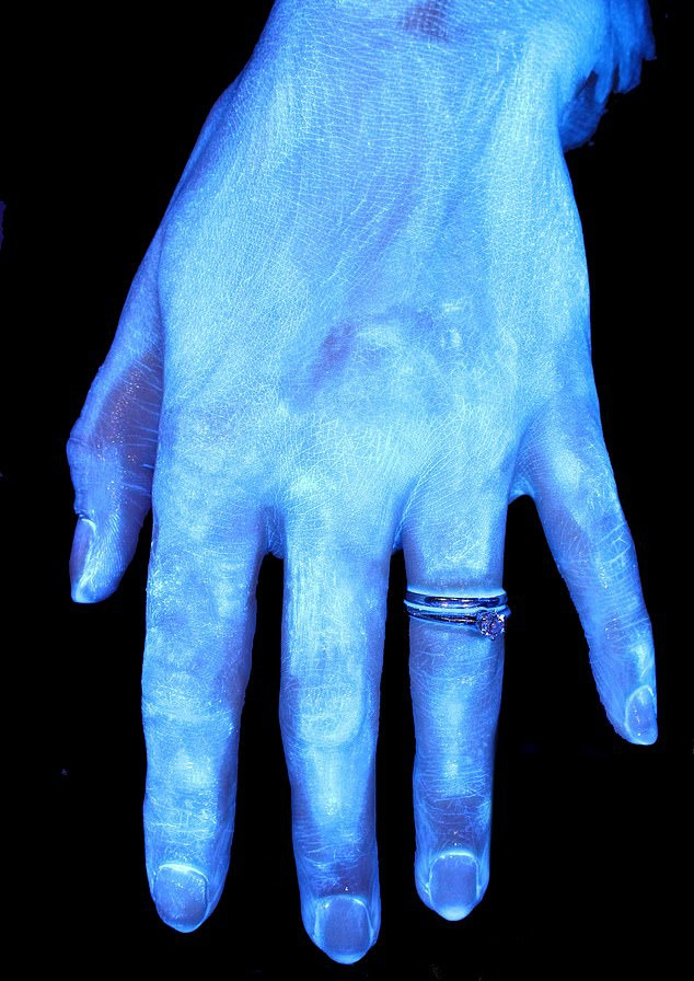 Hình ảnh gây sốc cho thấy bàn tay bạn nhiều vi khuẩn như thế nào và vai trò của việc rửa tay đúng kỹ thuật trong phòng tránh COVID-19 - Ảnh 2.