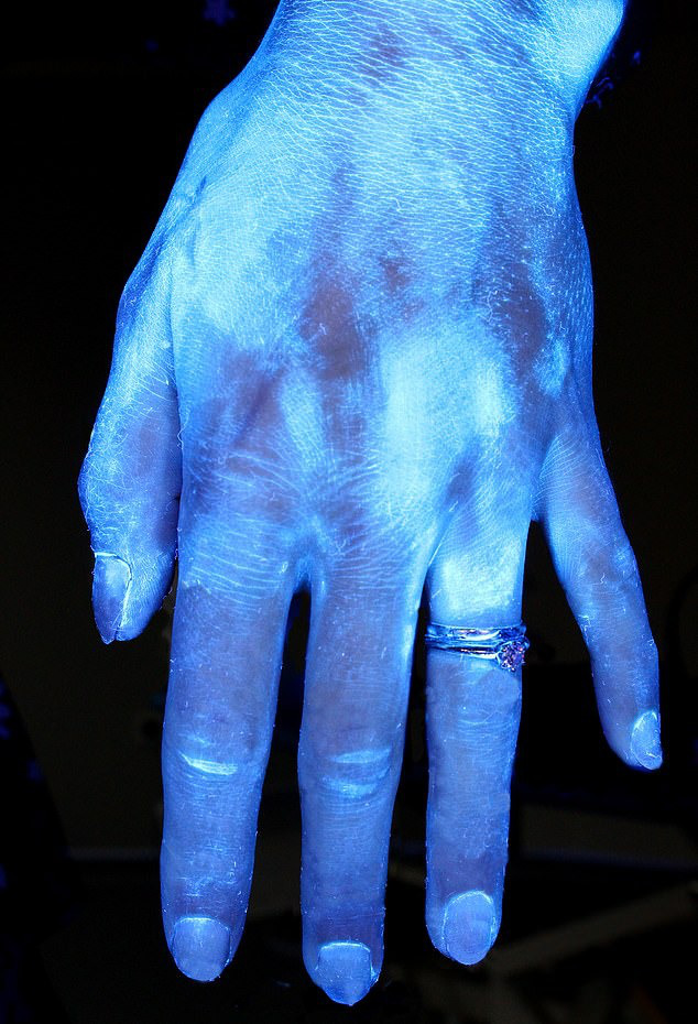 Hình ảnh gây sốc cho thấy bàn tay bạn nhiều vi khuẩn như thế nào và vai trò của việc rửa tay đúng kỹ thuật trong phòng tránh COVID-19 - Ảnh 3.