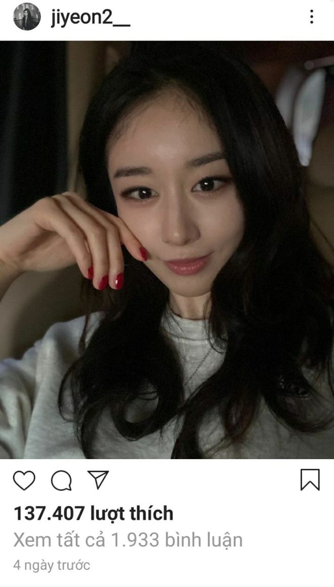 Điều netizen quan tâm nhất hiện tại: Giữa bão ly hôn của Lee Dong Gun - Jo Yoon Hee, liệu Jiyeon có động thái gì? - Ảnh 1.