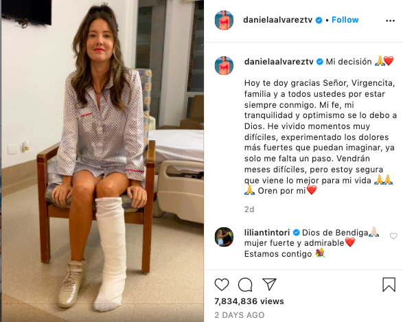 Xót xa nụ cười lạc quan cùng hình ảnh sắc vóc đỉnh cao của Hoa hậu Colombia bị cưa chân trái vì biến chứng phẫu thuật - Ảnh 3.