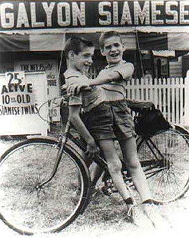 Nhìn lại hành trình 68 năm đồng hành của cặp sinh đôi dính liền sống lâu nhất thế giới: Sinh ra cùng nhau, chết đi cũng không rời - Ảnh 5.