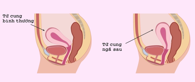 Đừng xem thường các chứng đau lưng bởi có khả năng bạn bị mắc các bệnh rất phổ biến - Ảnh 1.