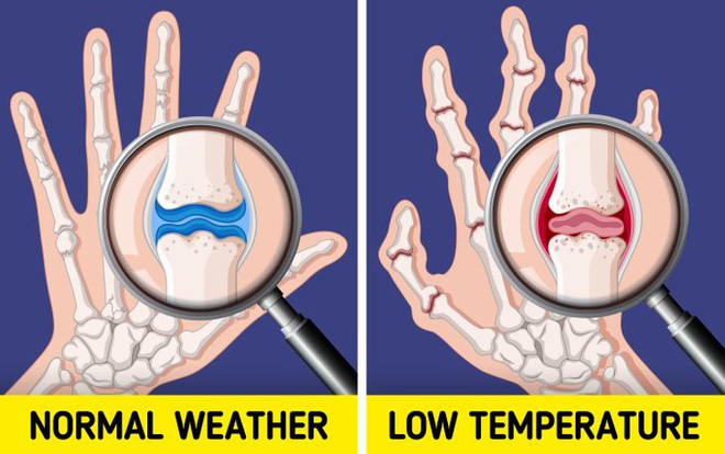 Đừng coi thường sưng tấy do nắng nóng hay da khô nứt nẻ vì giá lạnh, thời tiết có thể gây ra những tác hại đáng sợ thế này  với cơ thể - Ảnh 5.