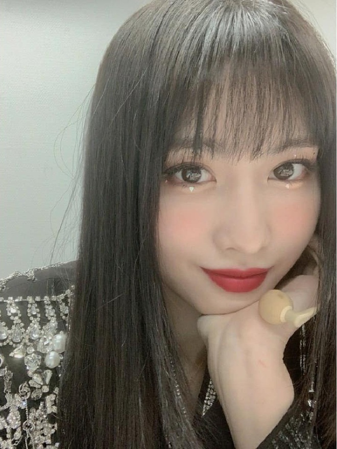 Momo (TWICE) than thở chuyện kiêng ăn hậu phẫu thuật nhưng nhan sắc mới gây chú ý - Ảnh 2.