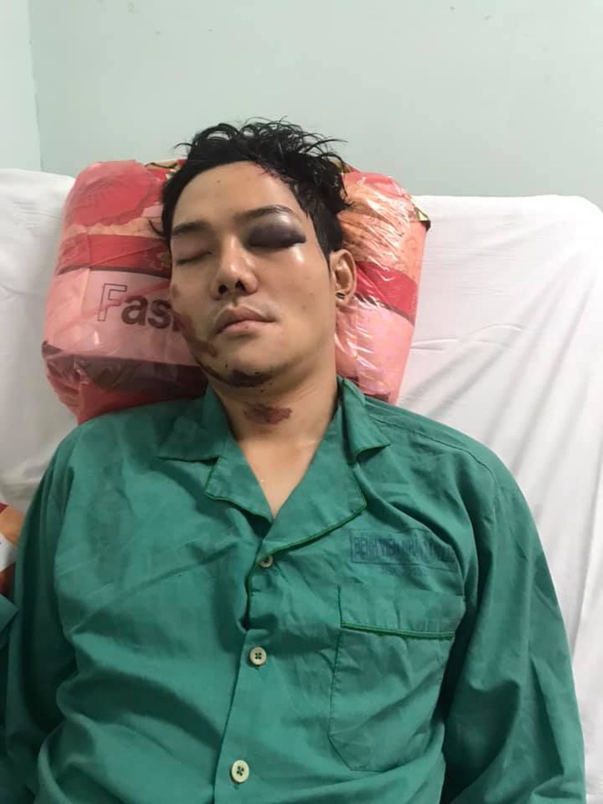 Sau tai nạn nghiêm trọng, con trai nuôi nghệ sĩ Hoài Linh phẫu thuật nối xương hàm bị gãy đôi vào sáng nay - Ảnh 2.