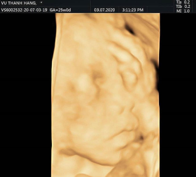 HOT: Hằng BingBoong khoe ảnh siêu âm, xác nhận mang thai con đầu lòng với bạn trai người Pháp gốc Việt - Ảnh 3.