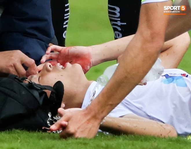 Cầu thủ trẻ HAGL chảy máu đầu đầm đìa sau va chạm vẫn cố thi đấu hết trận - Ảnh 3.