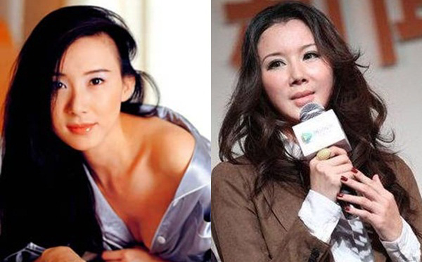 Những “quốc bảo” nhan sắc Cbiz tiêm botox đến... cứng đờ mặt