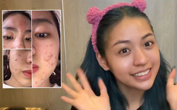 Thanh Tâm &quot;trứng rán&quot; đã lấy hết can đảm công khai mặt mộc nhưng vẫn bị antifan tố nói dối