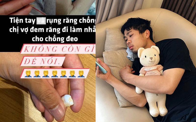 Công Phượng bình luận hài hước về sự việc vợ lấy răng chồng làm mặt nhẫn