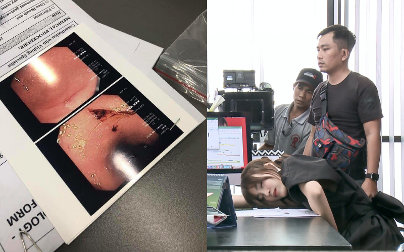 Netizen &quot;đào&quot; lại ảnh Lan Ngọc kiệt sức ở phim trường, nội soi dạ dày viêm loét đến chảy máu trước khi phát hiện tiền ung thư