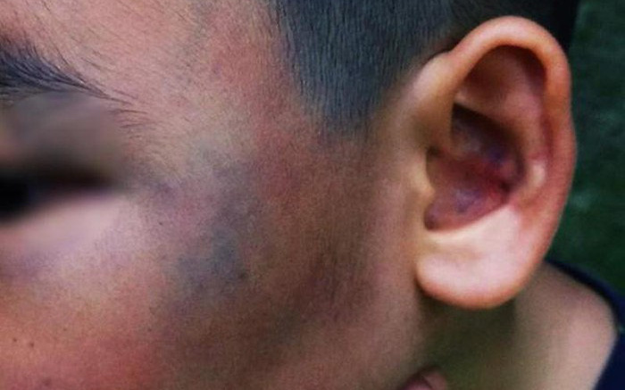 Kẻ đánh bé trai 8 tuổi đa chấn thương vì nghi trộm gà ở chung cư Sài Gòn nhận mức án 6 tháng tù treo