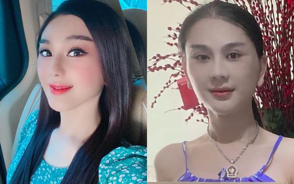 Hậu xác nhận can thiệp dao kéo, Lâm Khánh Chi lại gây chú ý với gương mặt cứng đờ như "tượng sáp"