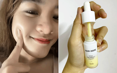 Serum vitamin C "lạ hoắc" của Hàn giúp làn da của cô bạn này lên tông, mờ thâm, lỗ chân lông nhỏ mịn thấy rõ chỉ sau 10 ngày