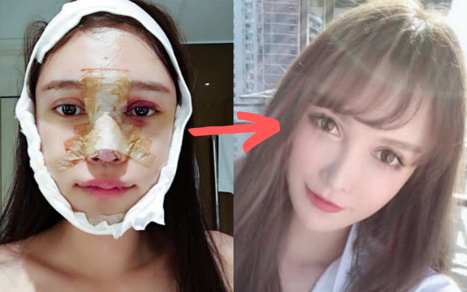 Ngành công nghiệp sắc đẹp Trung Quốc thời 4.0: Hành trình nguy hiểm từ các app tư vấn 'đập đi xây lại' đến hàng chục lần nằm trên bàn mổ