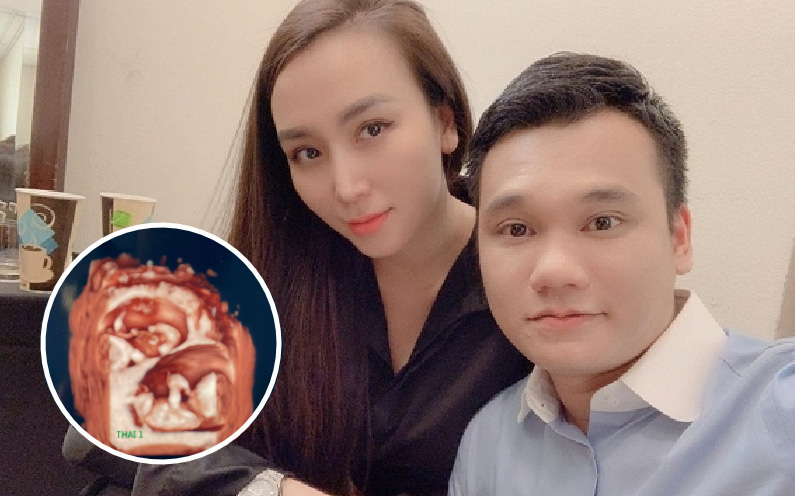 Vbiz liên tục nhận tin vui: Khắc Việt thông báo vợ mang thai đôi, định giấu nhưng quyết công khai vì 1 đồng nghiệp