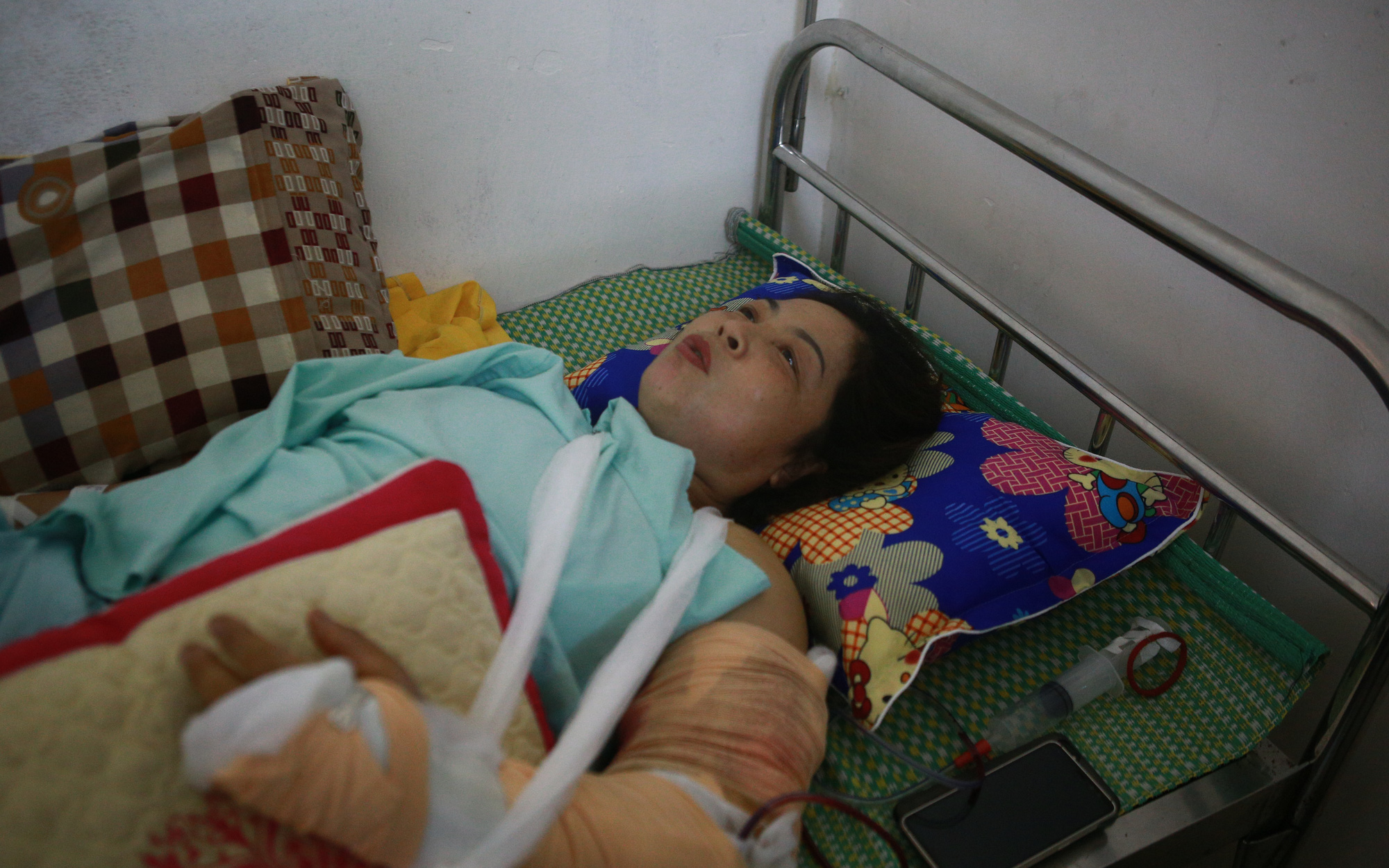 Tình hình sức khỏe của các nạn nhân bị thương trong vụ lốc xoáy ở Vĩnh Phúc: 2 bệnh nhân nặng bị gãy xương đùi, có biểu hiện sốc chấn thương