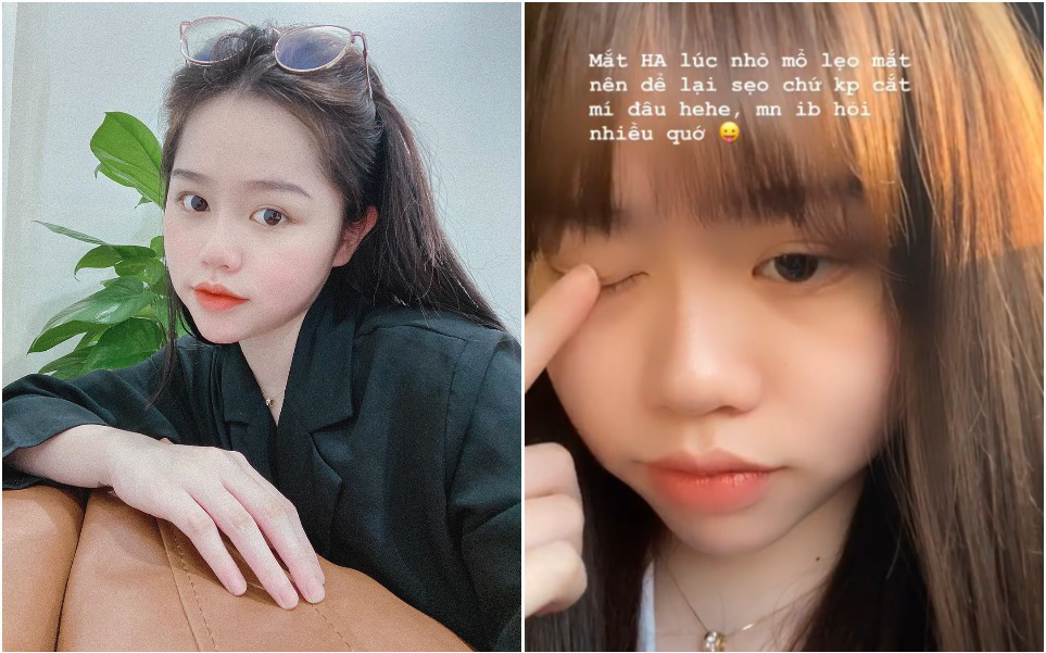 Nói chung là vẫn chưa hết bị soi, bạn gái Quang Hải vừa lý giải vì sao có đôi mắt trông như cắt mí