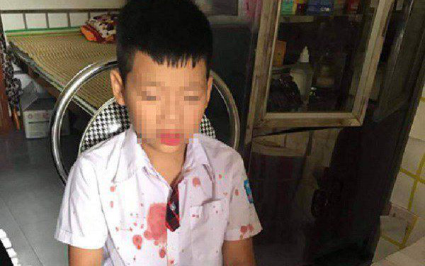Vụ người đàn ông đấm hộc máu mồm bé học sinh lớp 1 để “trả thù” cho con: Nhà trường chính thức lên tiếng