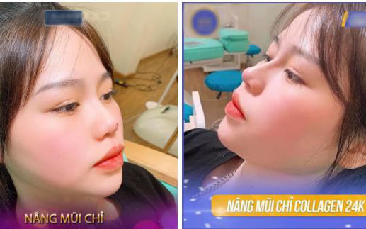 Xôn xao hình ảnh Huỳnh Anh (bạn gái Quang Hải) đi phẫu thuật thẩm mỹ: Chủ nhân bức ảnh nói gì?