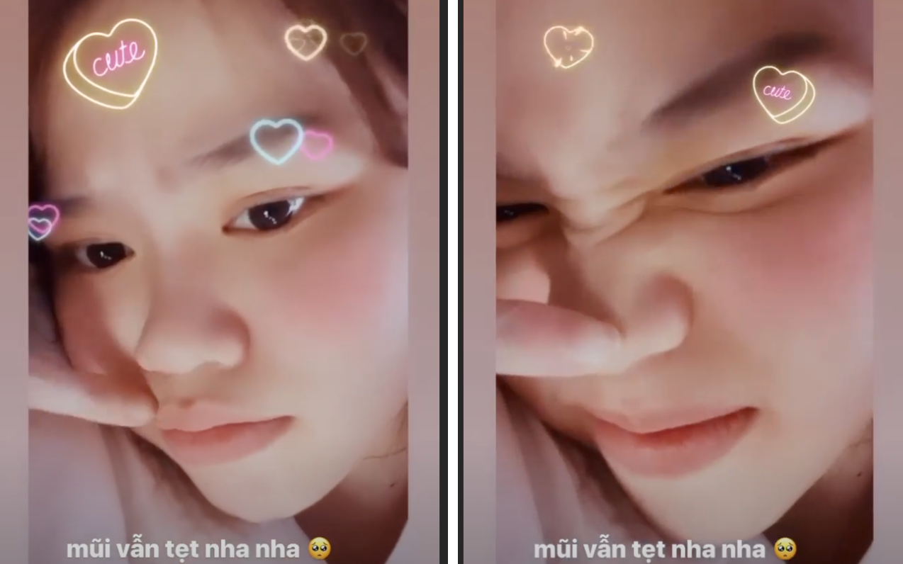 Bị đồn sửa mũi, Huỳnh Anh - bạn gái Quang Hải quay luôn clip chứng minh không dao kéo