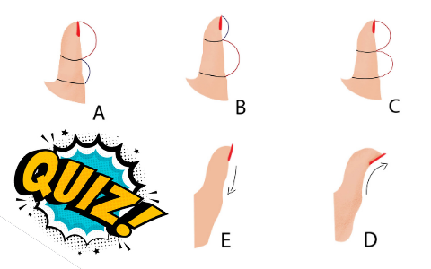 Quiz: Ngón tay cái của bạn có hình dạng như thế nào? Đặc điểm cơ thể rất nhỏ này lại tiết lộ khá nhiều về tính cách của bạn đấy!
