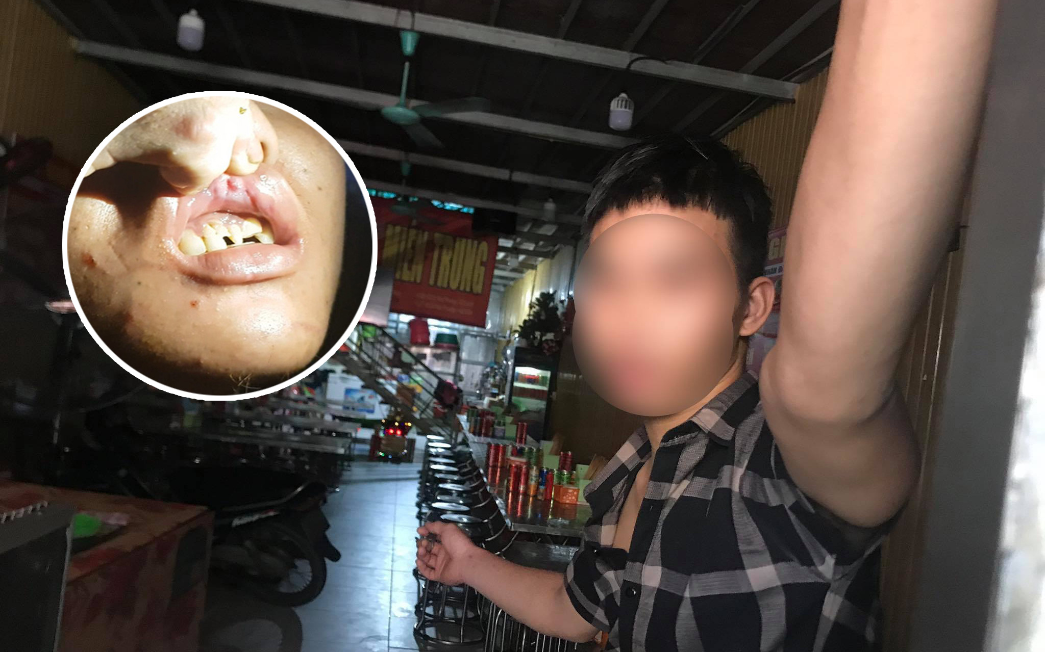 Anh trai nhân viên 15 tuổi nghi bị chủ quán bánh xèo bạo hành dã man ở Bắc Ninh: "Tôi rất xót xa!"