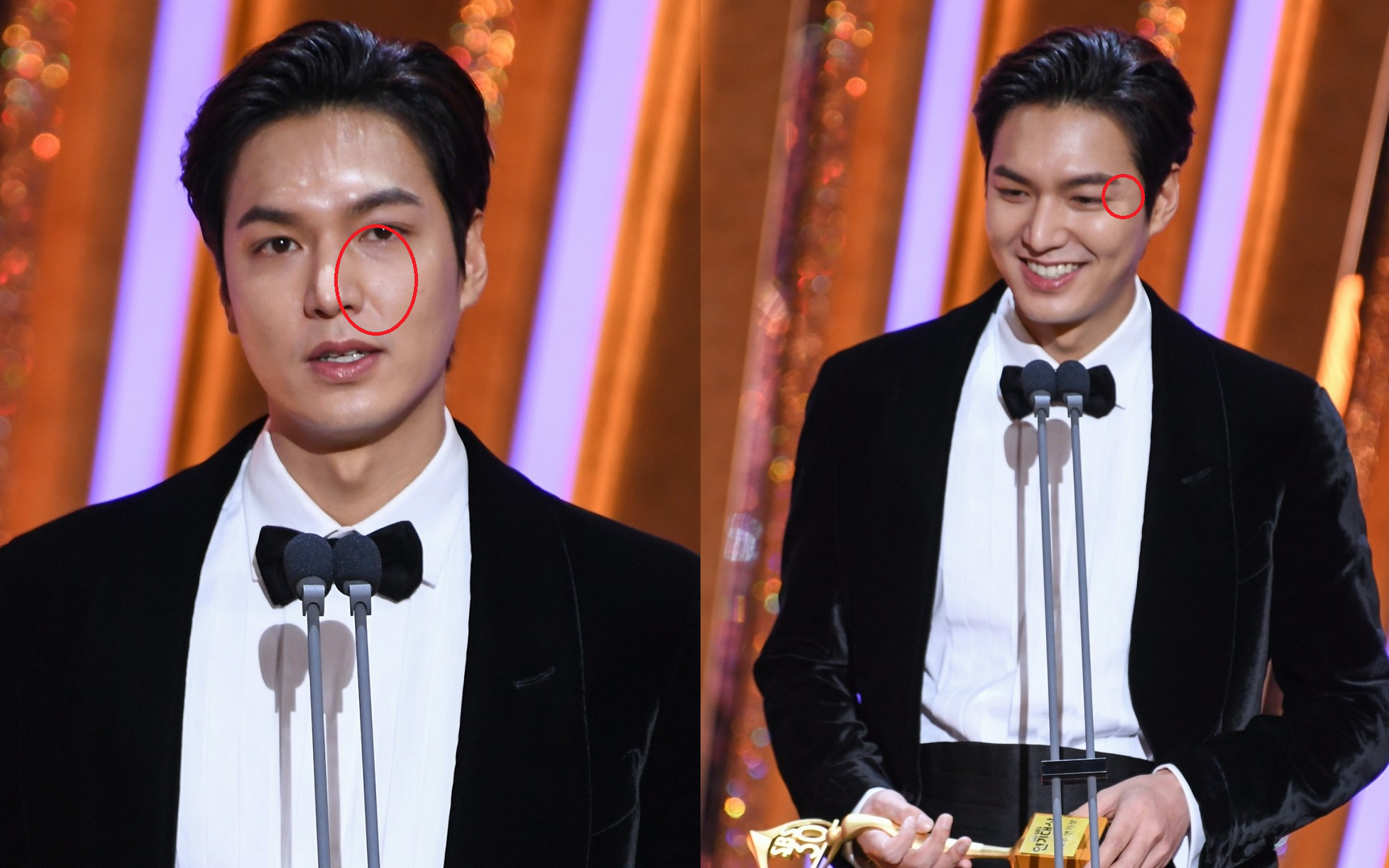 Lee Min Ho lâu lắm mới dự lễ trao giải SBS Drama Awards 2020, ai ngờ gây tranh cãi dữ dội vì lộ dấu hiệu lão hóa