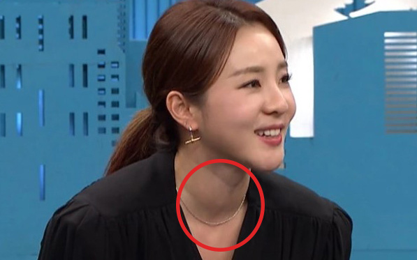 Dara (2NE1) khiến fan lo lắng khi lên sóng với cổ sưng to, liệu có liên quan bệnh về tuyến giáp?
