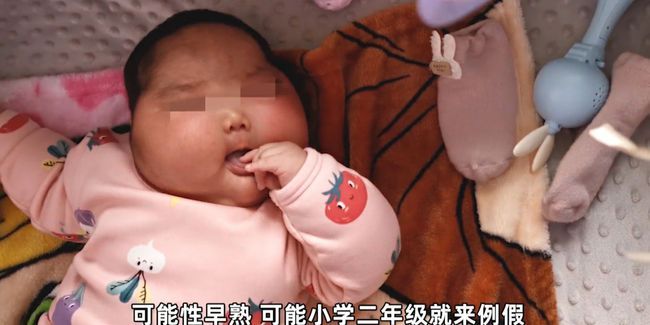 Bé trai 5 tháng tuổi bỗng dưng bị to đầu sau khi sử dụng kem kháng khuẩn sản xuất tại Trung Quốc? - Ảnh 1.