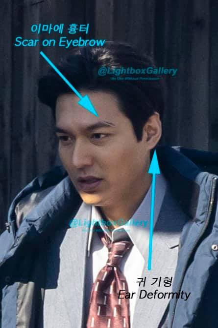 Lee Min Ho lộ biến chứng dao kéo trong ảnh team qua đường: Lời giải thích của fan liệu có hợp lý? - Ảnh 3.