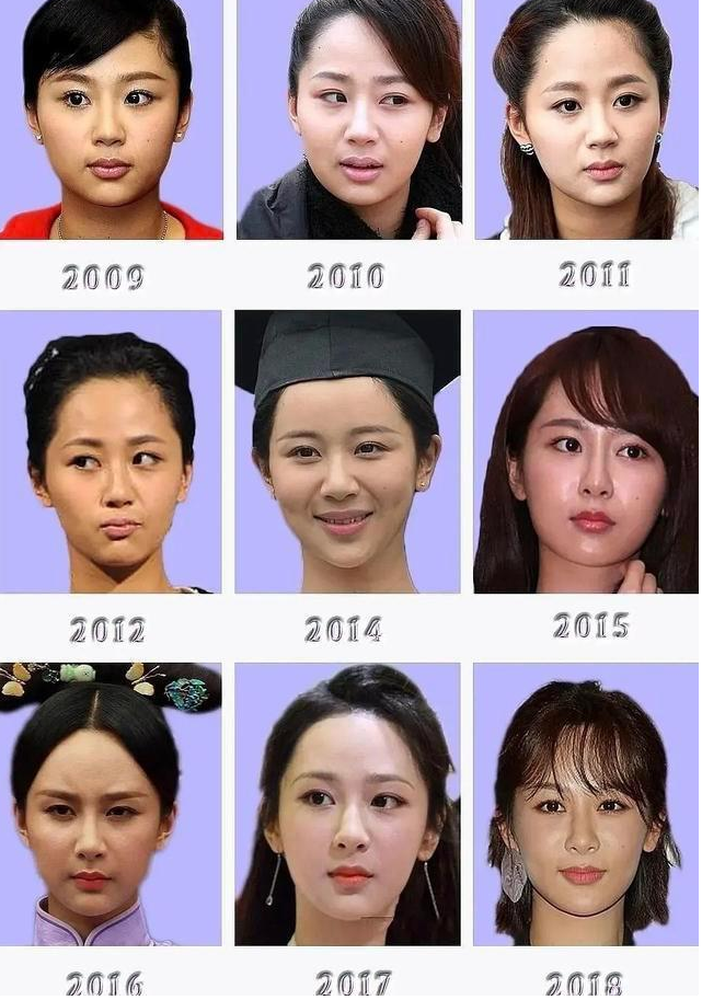 Dương Tử ngày càng khác lạ: Gương mặt gượng gạo, biểu cảm cứng đờ, dao kéo quá đà hay gì đây? - Ảnh 8.