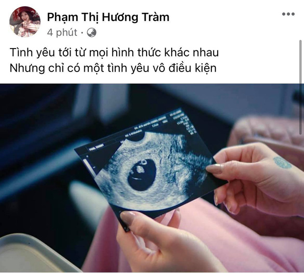 Cao Thái Sơn vô tình để lộ vòng 2 lùm lùm của Hương Tràm, lời chúc ẩn ý như thay chính chủ xác nhận tin bầu bí? - Ảnh 4.