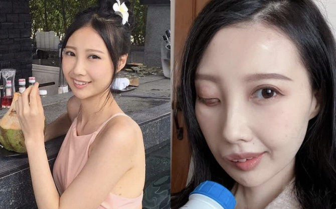 9 năm chiến đấu với bệnh ung thư hiếm gặp, nữ ca sĩ đã trút hơi thở cuối cùng ở tuổi 31 với gương mặt biến dạng