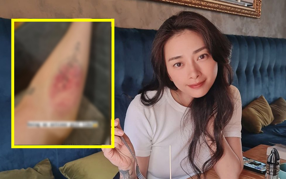 Ngô Thanh Vân đăng ảnh bị đánh đáng lo ngại trên MXH, nghi vấn đang bí mật &quot;toan tính&quot; gì đó ở Hollywood?