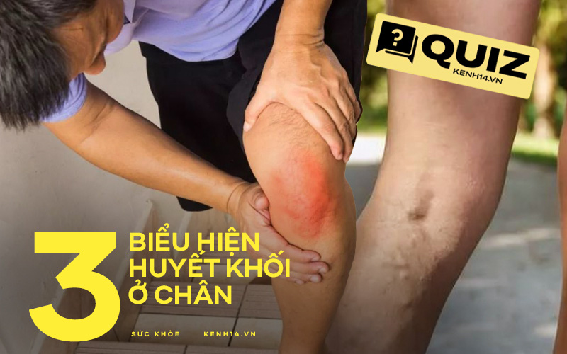 Quiz: 3 biểu hiện ở chân cho thấy máu trong cơ thể đang &quot;đặc như cháo&quot;, không chú ý mà bỏ qua thì đến lúc hối hận không kịp