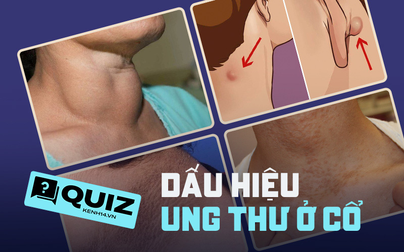 Quiz: Bạn có đang gặp phải những dấu hiệu cảnh báo tế bào ung thư ở vùng cổ không?