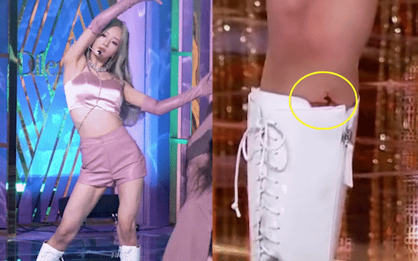Nữ idol 11 năm tuổi nghề bị thương chảy máu ròng ròng vẫn điềm nhiên biểu diễn, netizen khen chuyên nghiệp nhưng trách stylist hết lời