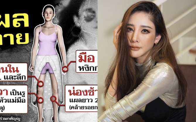NÓNG: Công bố toàn bộ vết thương trên thi thể nữ diễn viên Chiếc Lá Bay khi tử nạn, luật sư hé lộ tên nhân vật sắp bị khởi tố