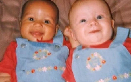 Cặp chị em sinh đôi “khác nhau nhất thế giới” trái ngược từ màu da đến mái tóc từng gây xôn xao khó hiểu giờ trông thế nào sau 25 năm?