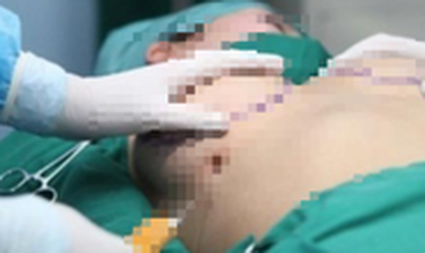 Vụ người phụ nữ 61 tuổi tử vong sau khi nâng ngực: Bệnh viện thẩm mỹ Kangnam Sài Gòn lên tiếng - Ảnh 1.