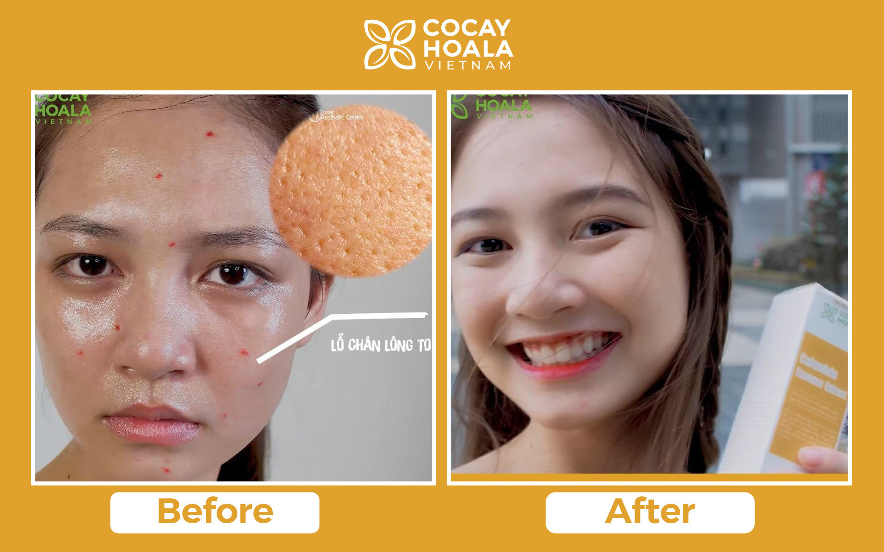Thử tinh chất hoa cúc 2in1 Cỏ Cây Hoa Lá được nàng da dầu ngợi ca hết lời