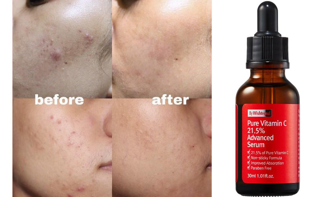 Có giá chưa đến 400.000 VNĐ, chai serum này có gì hot mà nhận hơn 100.000 lượt đánh giá 5 sao trên toàn thế giới?