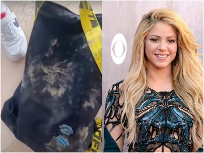 Shakira và con trai 8 tuổi bị 2 con lợn rừng tấn công... cướp túi giữa đường và cái kết không thể thốn hơn cùng đống lông heo - Ảnh 3.
