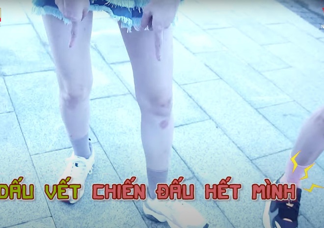 Lan Ngọc lộ diện với đôi chân bầm tím tại Running Man Việt, khẳng định 1 điều khiến fan xót xa - Ảnh 2.