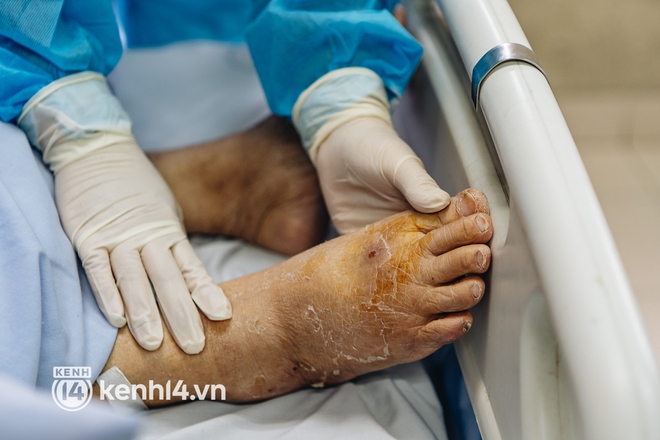 F0 thể nhẹ nhưng nguy kịch hậu Covid-19, bác sĩ khuyến cáo những triệu chứng báo động đỏ cần nhập viện ngay! - Ảnh 2.