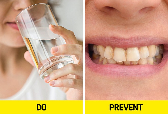 6 thói quen khiến răng của bạn dễ bị ố vàng - Ảnh 6.