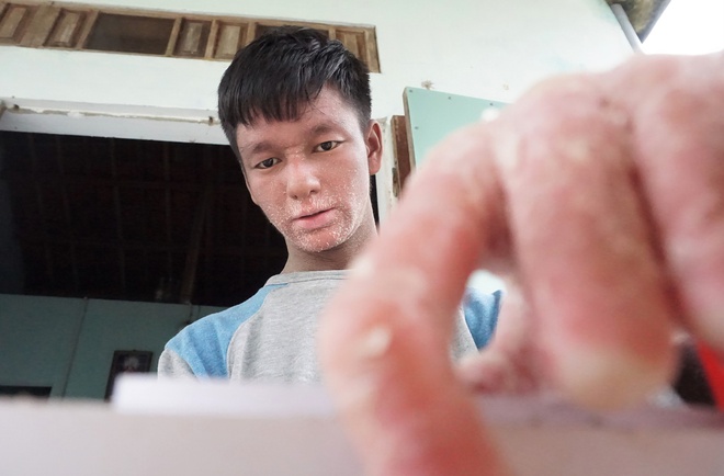 Cuộc sống của cha con người rắn ở Quảng Nam giờ ra sao? - Ảnh 10.